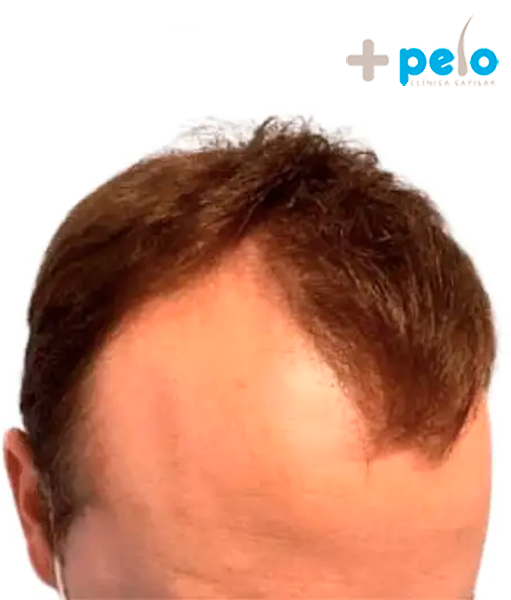 Before image