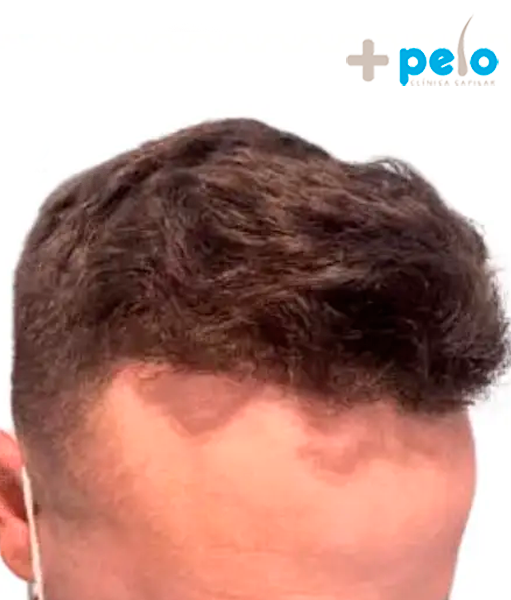After image