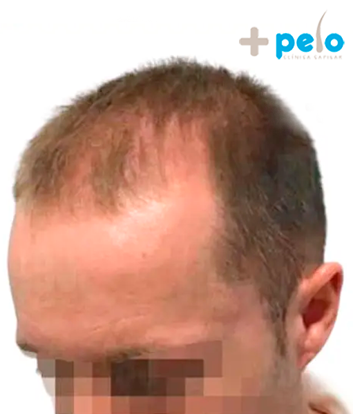 Before image