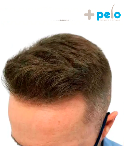 After image