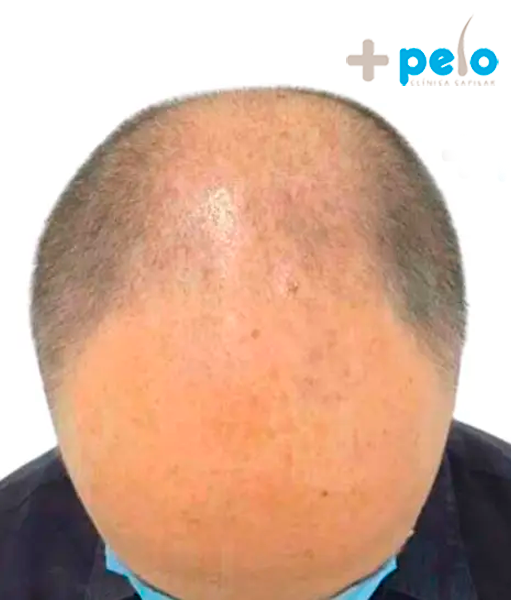 Before image