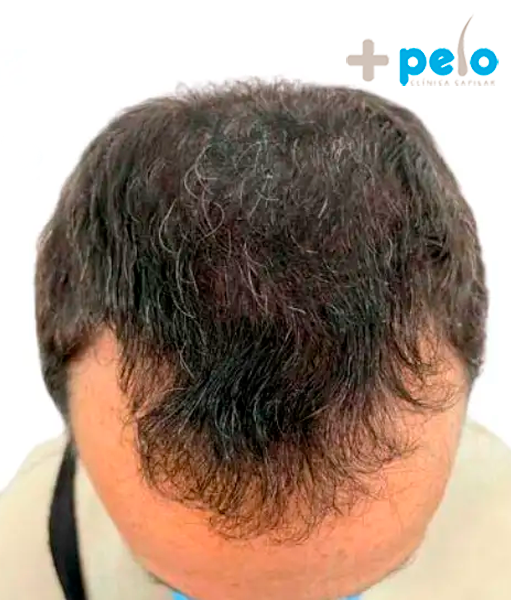 After image