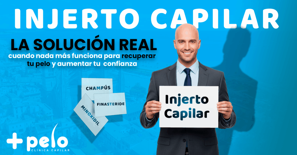 Injerto capilar solución definitiva mallorca