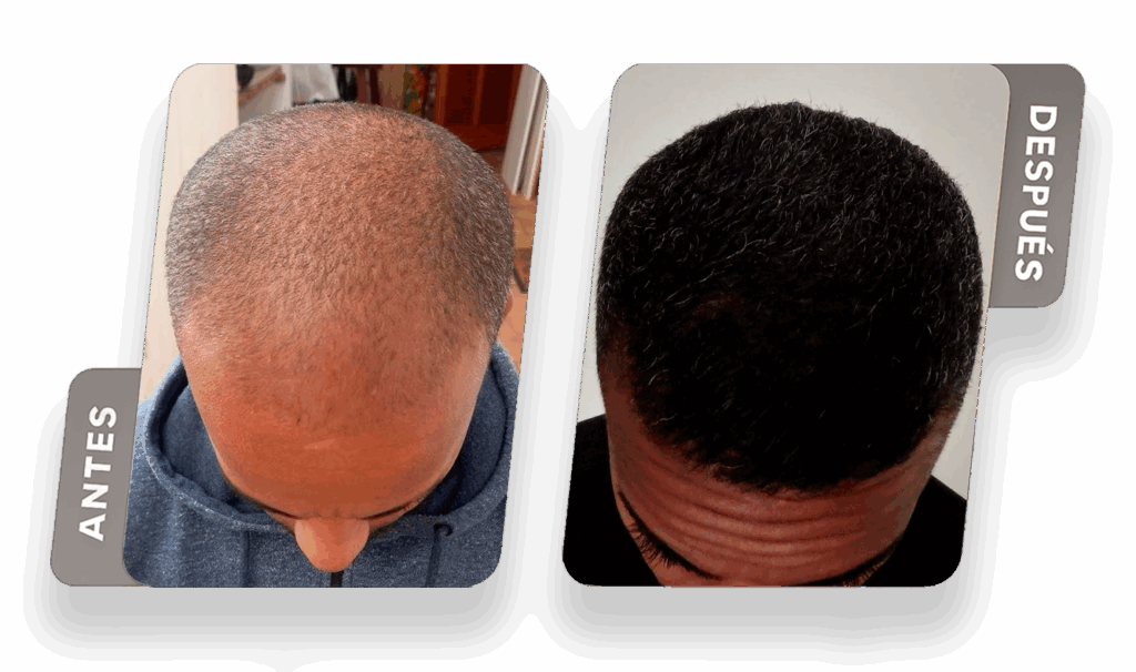 Wellington - Más Pelo